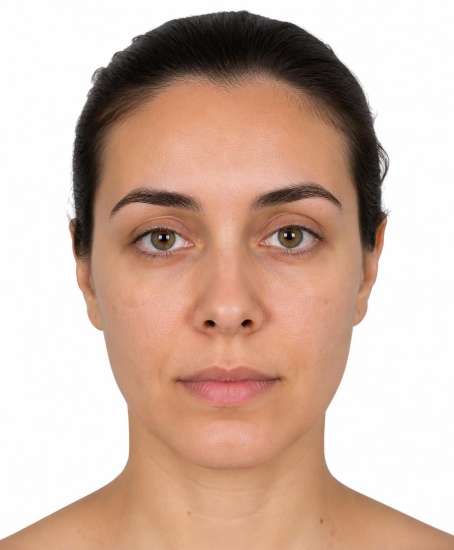 Referencia facial de áreas descritas por el fabricante