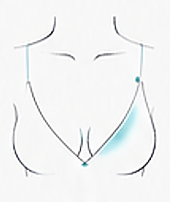 Ilustración de Escote